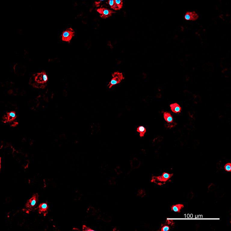 Ankyron IL10_HUMAN Clone AB40107
