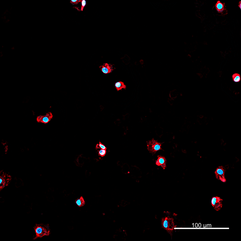 Ankyron IL10_HUMAN Clone AB40102