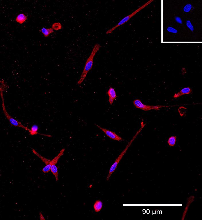 Ankyron IL10_HUMAN Clone AB40104