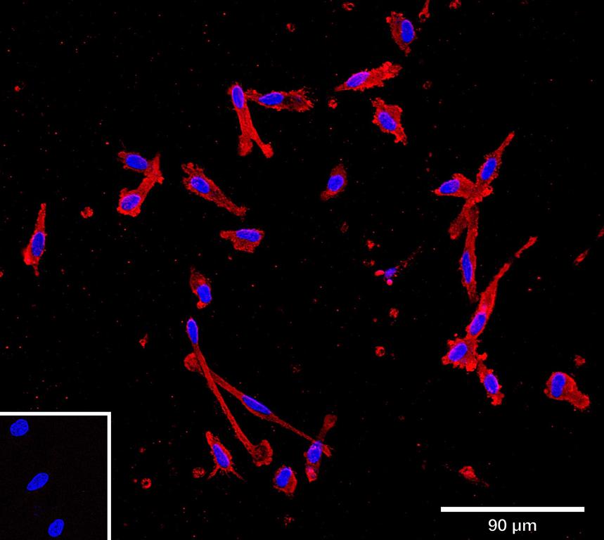 Ankyron IL10_HUMAN Clone AB40102