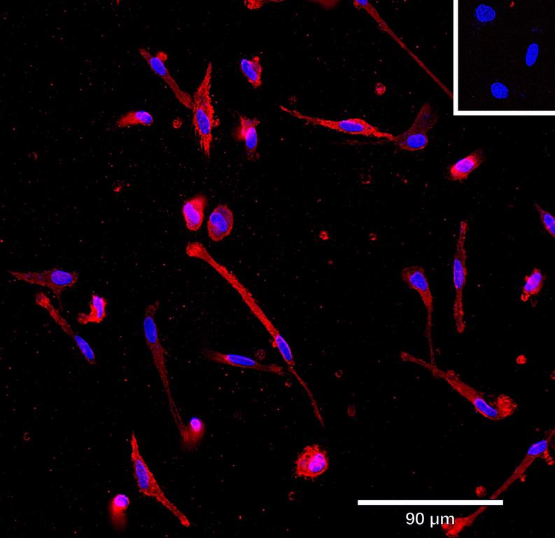 Ankyron IL10_HUMAN Clone AB40107