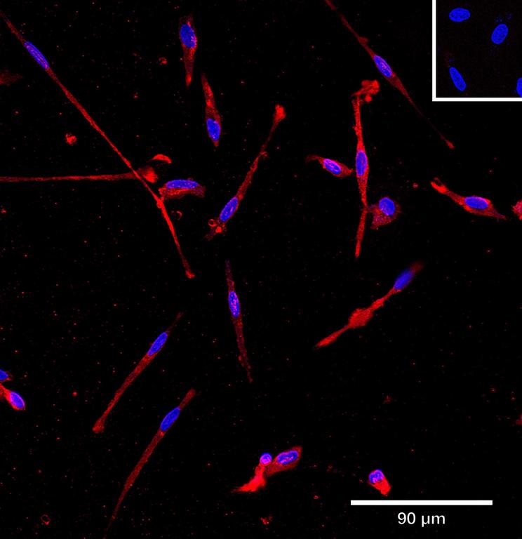 Ankyron IL10_HUMAN Clone AB40101