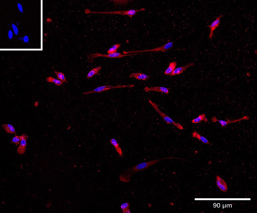 Ankyron IL10_HUMAN Clone AB40106