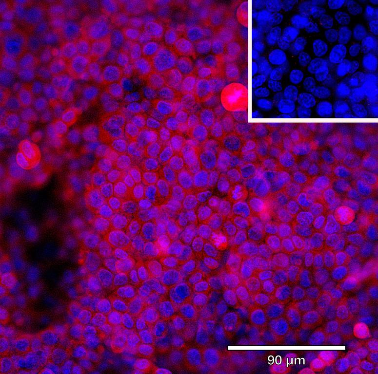 Ankyron IL11_HUMAN Clone BA40823