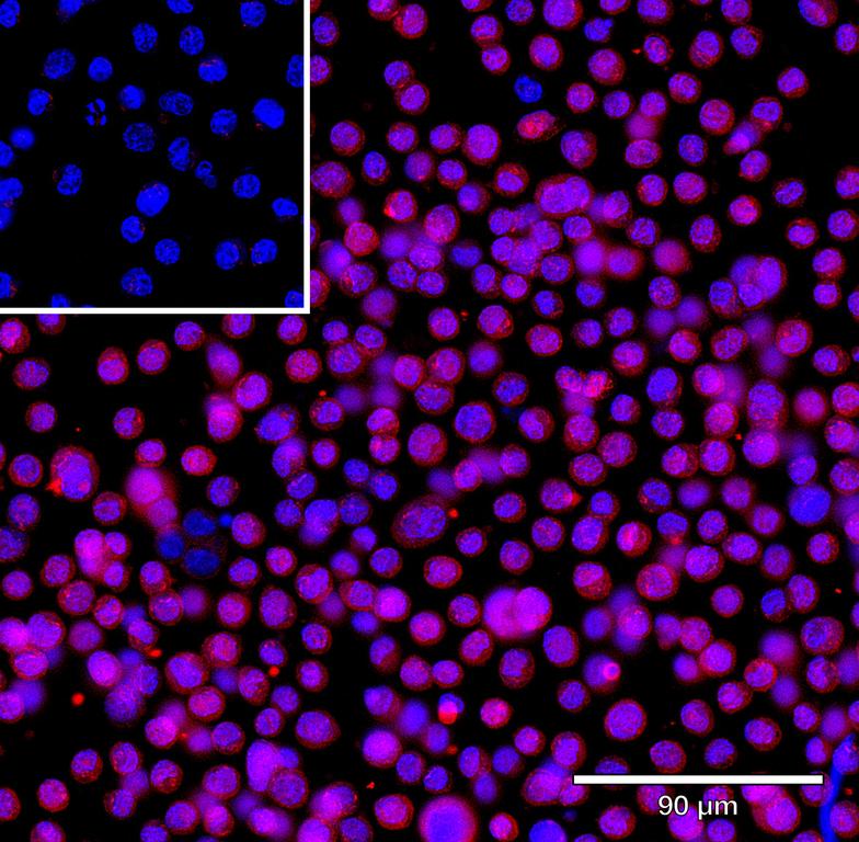 Ankyron IL11_HUMAN Clone CV40230