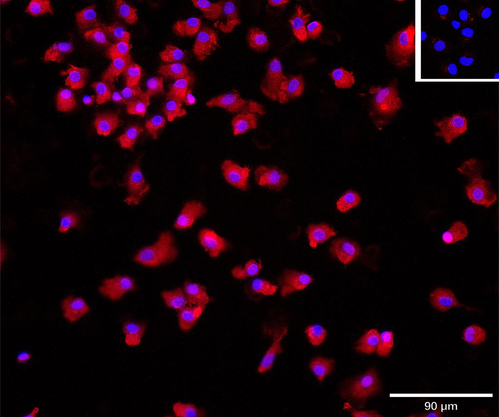 Ankyron IL12B_HUMAN Clone CI30165