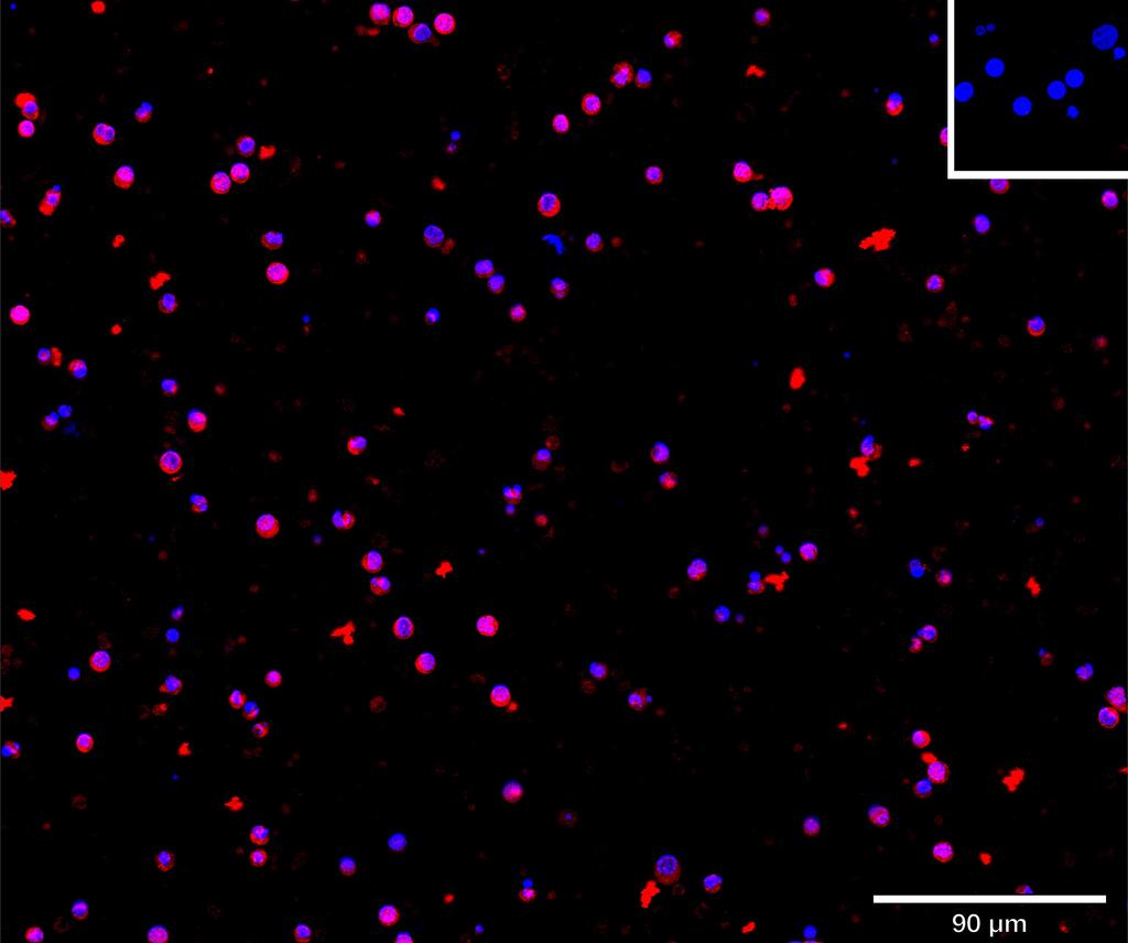 Ankyron IL13_HUMAN Clone CI30122