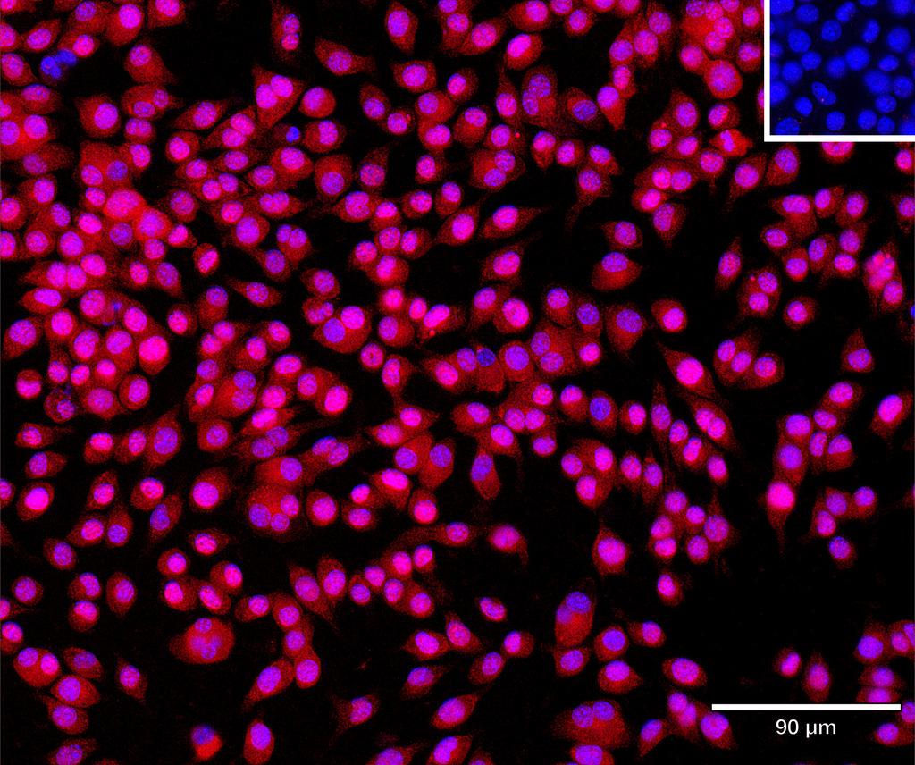 Ankyron IL1AP_MOUSE Clone AT40863
