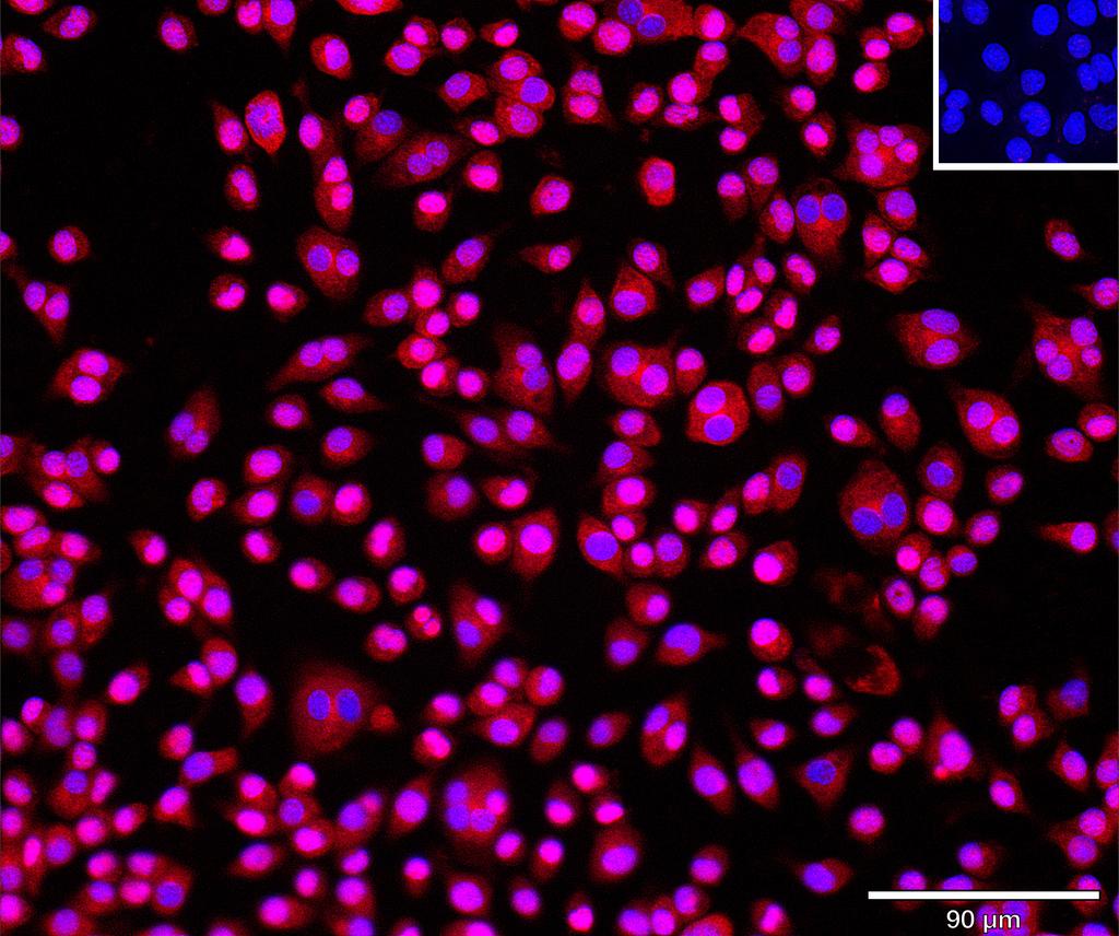 Ankyron IL1AP_MOUSE Clone AT40874