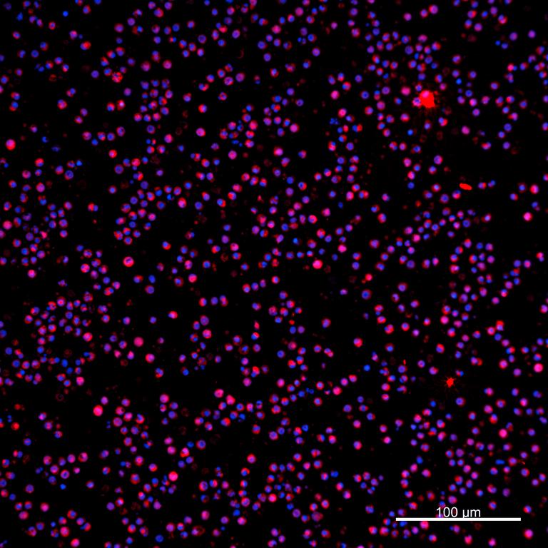 Ankyron IL2_HUMAN Clone AB30153
