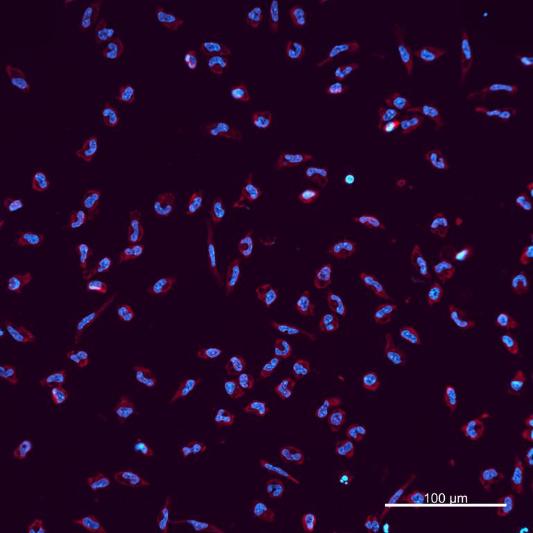 Ankyron IL32_HUMAN Clone AW40534
