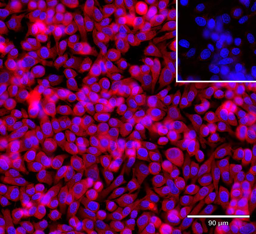 Ankyron IL36G_HUMAN Clone AG40107
