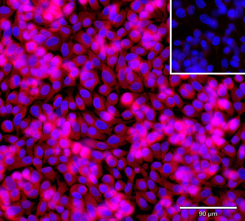 Ankyron IL36G_HUMAN Clone AG40106