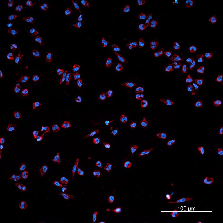 Ankyron IL37_HUMAN Clone BA40518