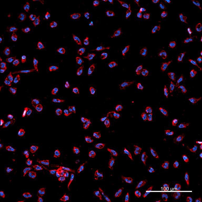 Ankyron IL37_HUMAN Clone BA40520
