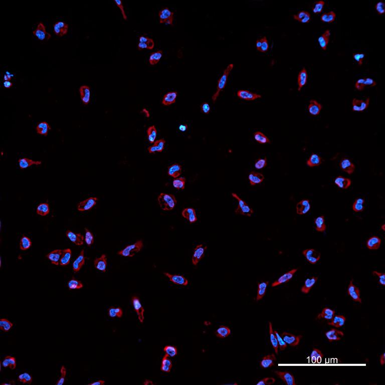 Ankyron IL37_HUMAN Clone BA40521