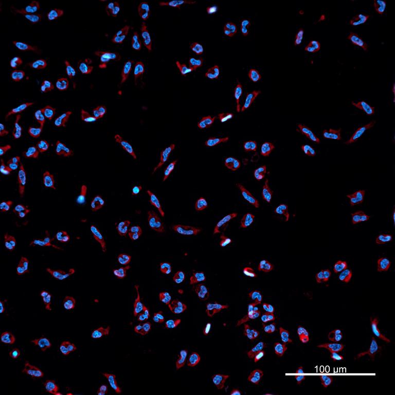 Ankyron IL37_HUMAN Clone BA40524