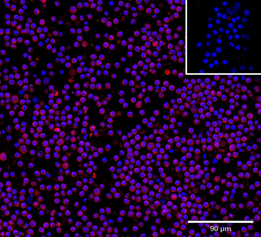 Ankyron IL3_HUMAN Clone BG40592