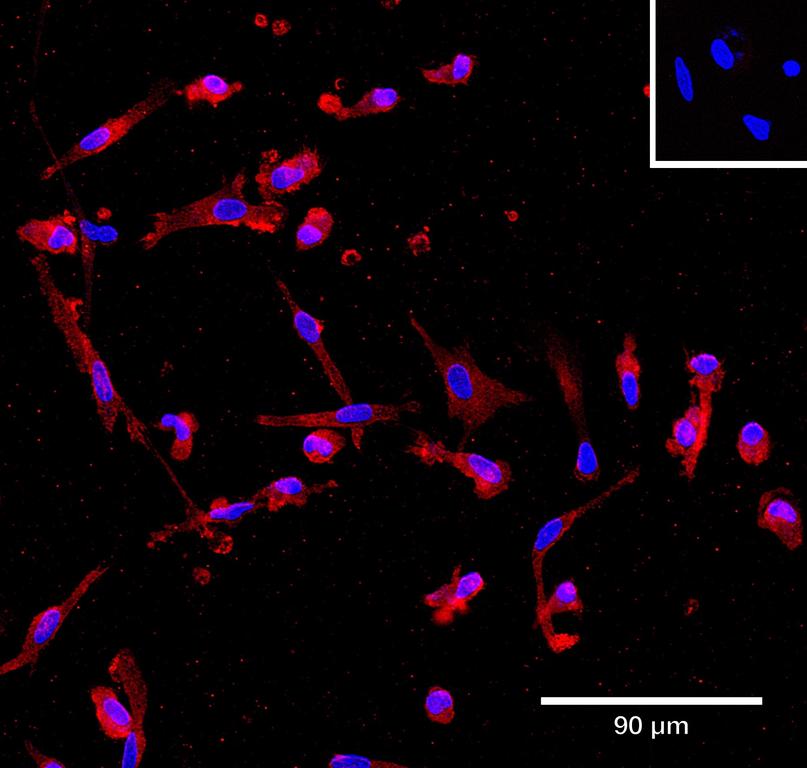 Ankyron IL6_HUMAN Clone AA40228