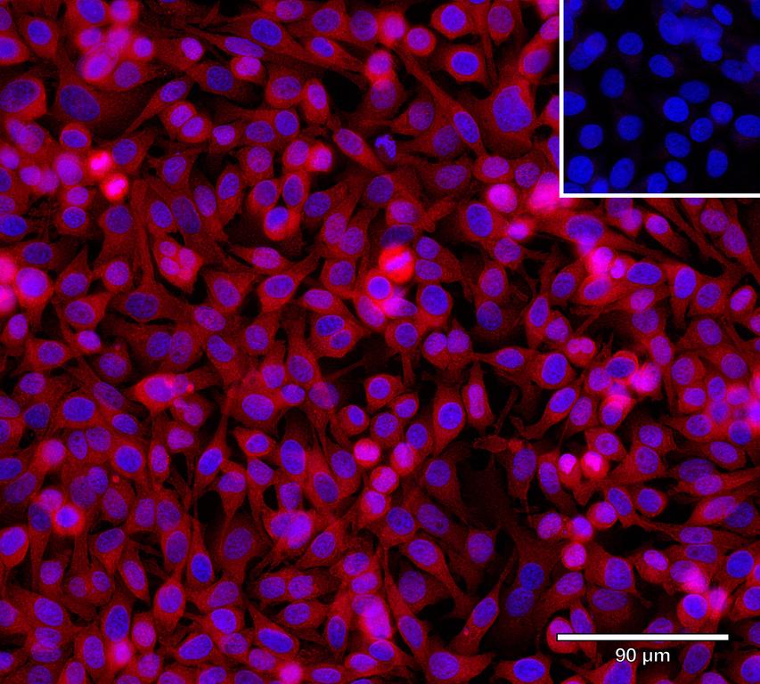 Ankyron IL6_HUMAN Clone AA40220