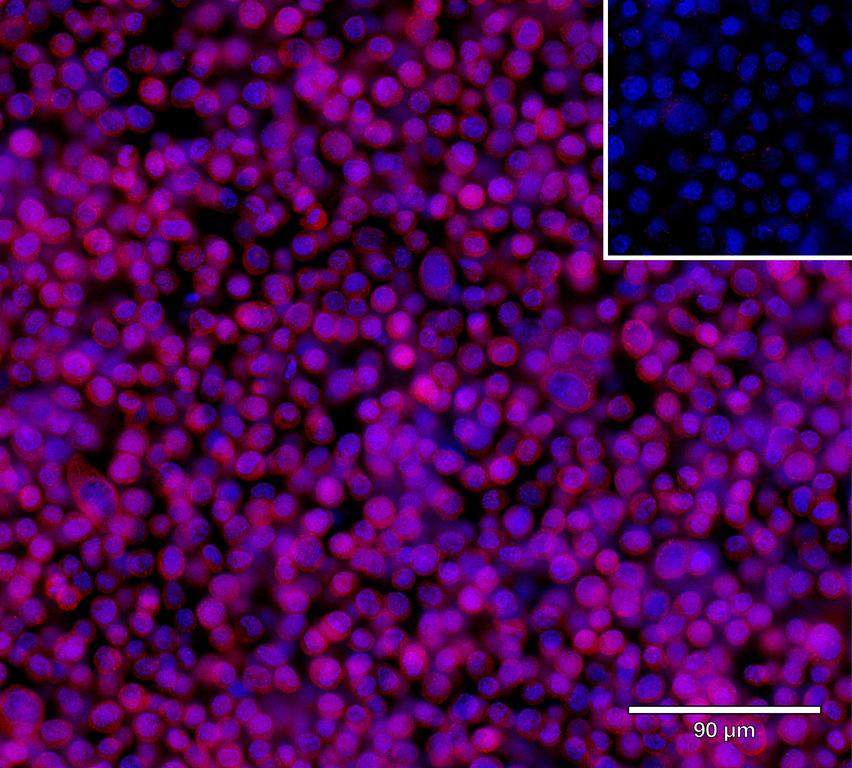 Ankyron IL7_HUMAN Clone DS40490
