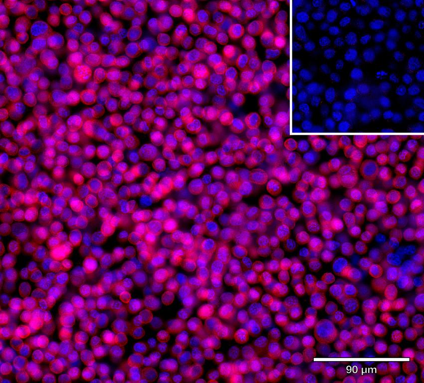 Ankyron IL7_HUMAN Clone DR40129