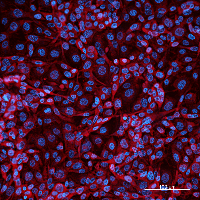 Ankyron IL8_HUMAN Clone AB40355