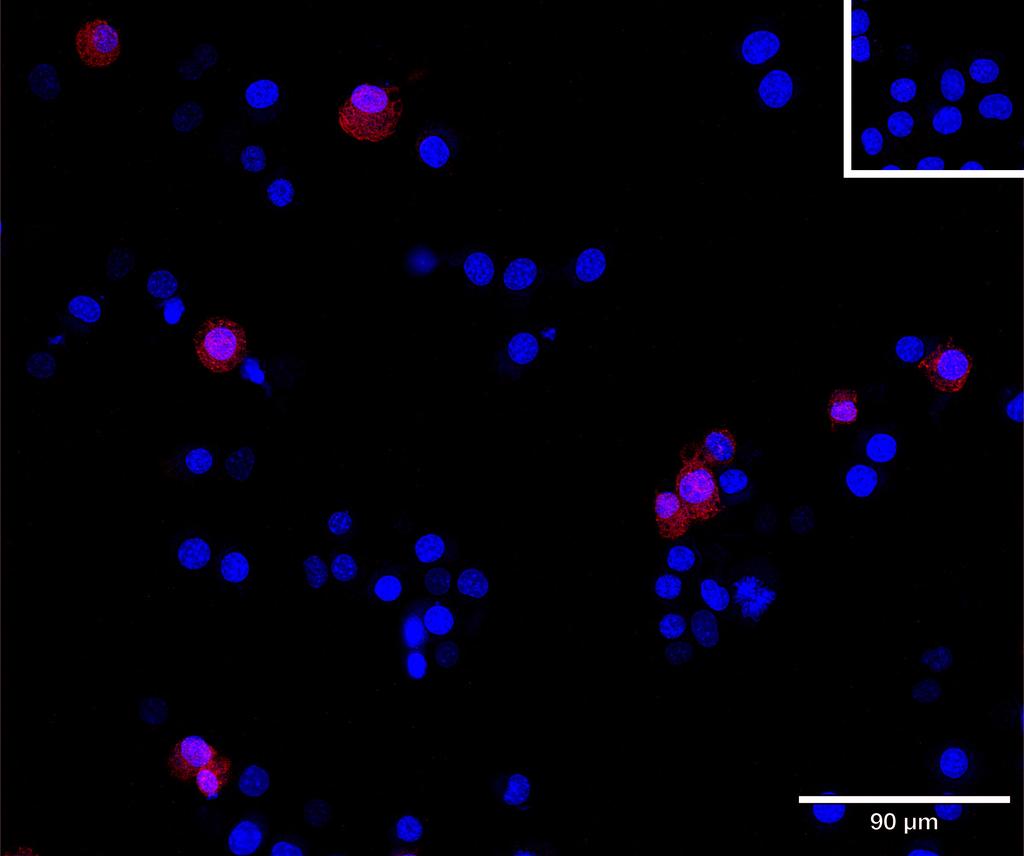 Ankyron ILRL1_MOUSE Clone AU41389