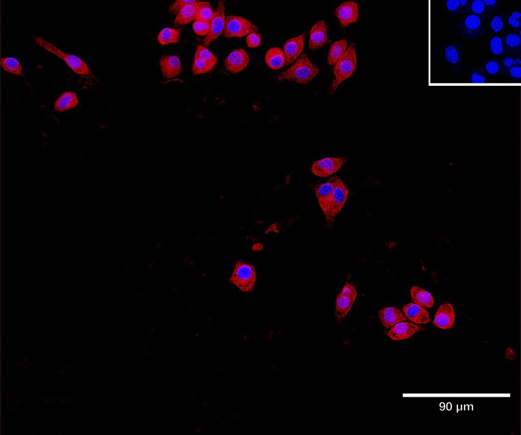 Ankyron INAR1_MOUSE Clone AU41049