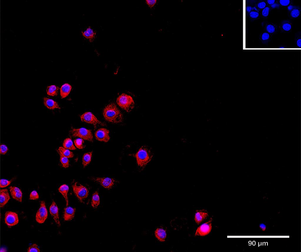 Ankyron INAR1_MOUSE Clone AU41053