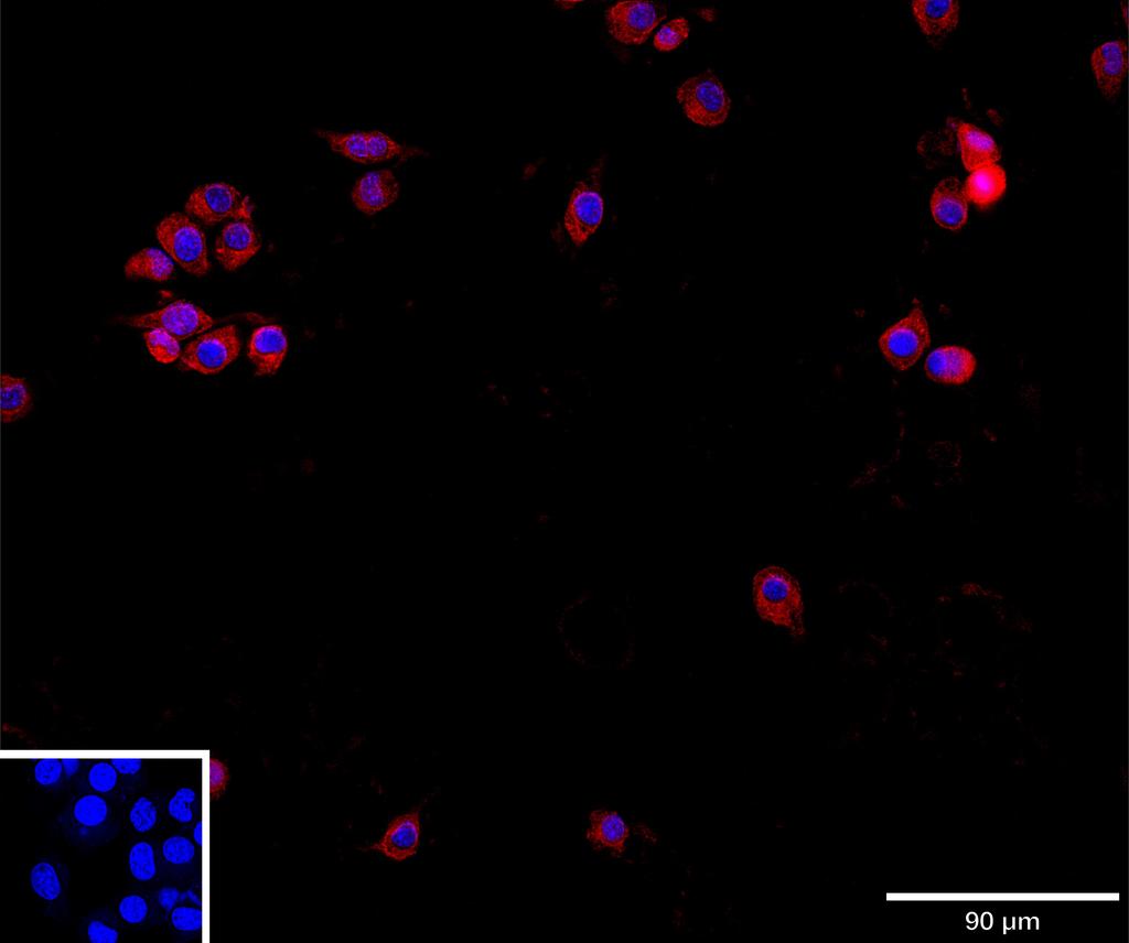 Ankyron INAR1_MOUSE Clone AU41055