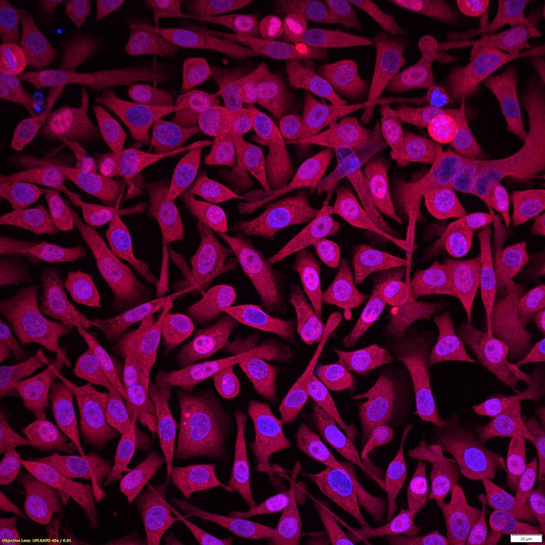 Ankyron INHBA_HUMAN Clone AF40242