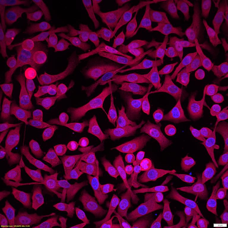 Ankyron INHBA_HUMAN Clone AF40246