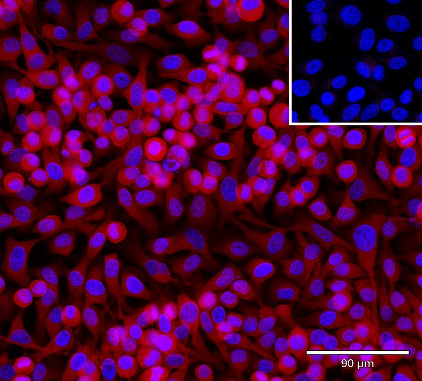Ankyron INHBA_HUMAN Clone AF40243