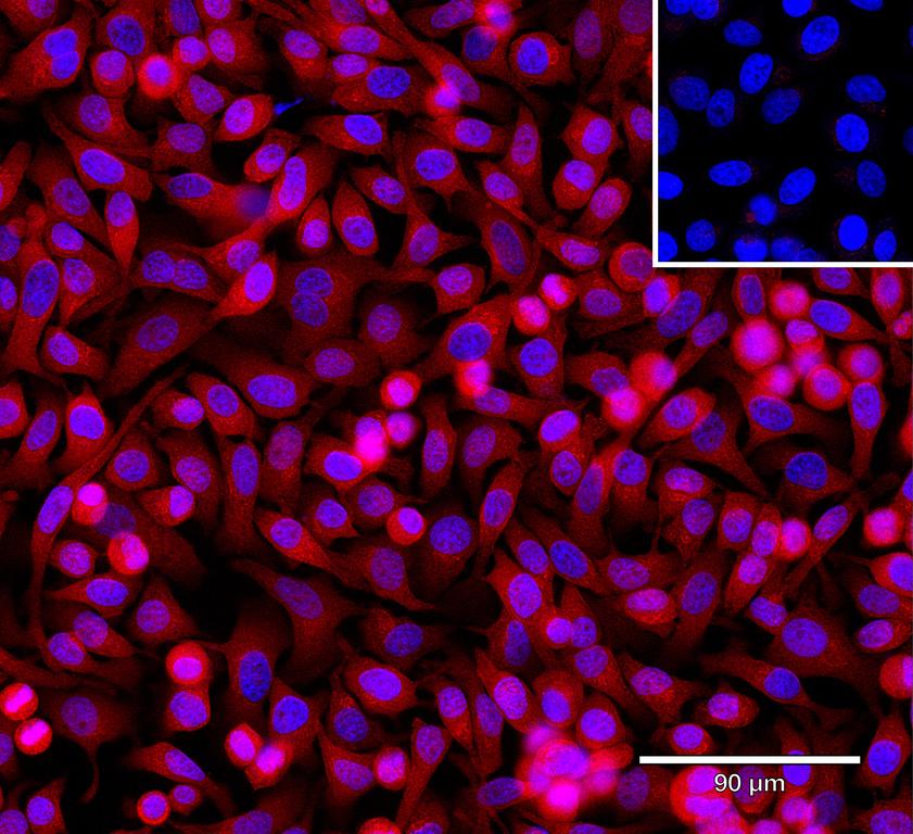 Ankyron INHBA_HUMAN Clone AF40245