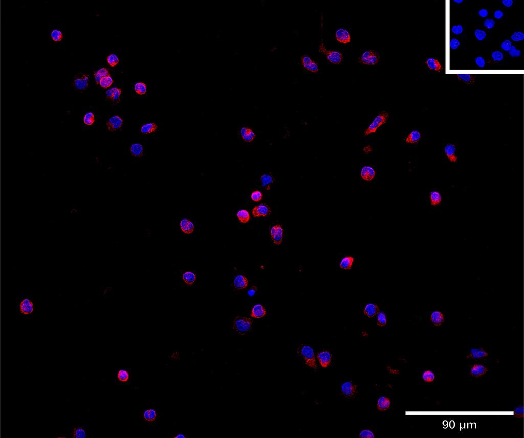 Ankyron IRPL1_HUMAN Clone DN40121