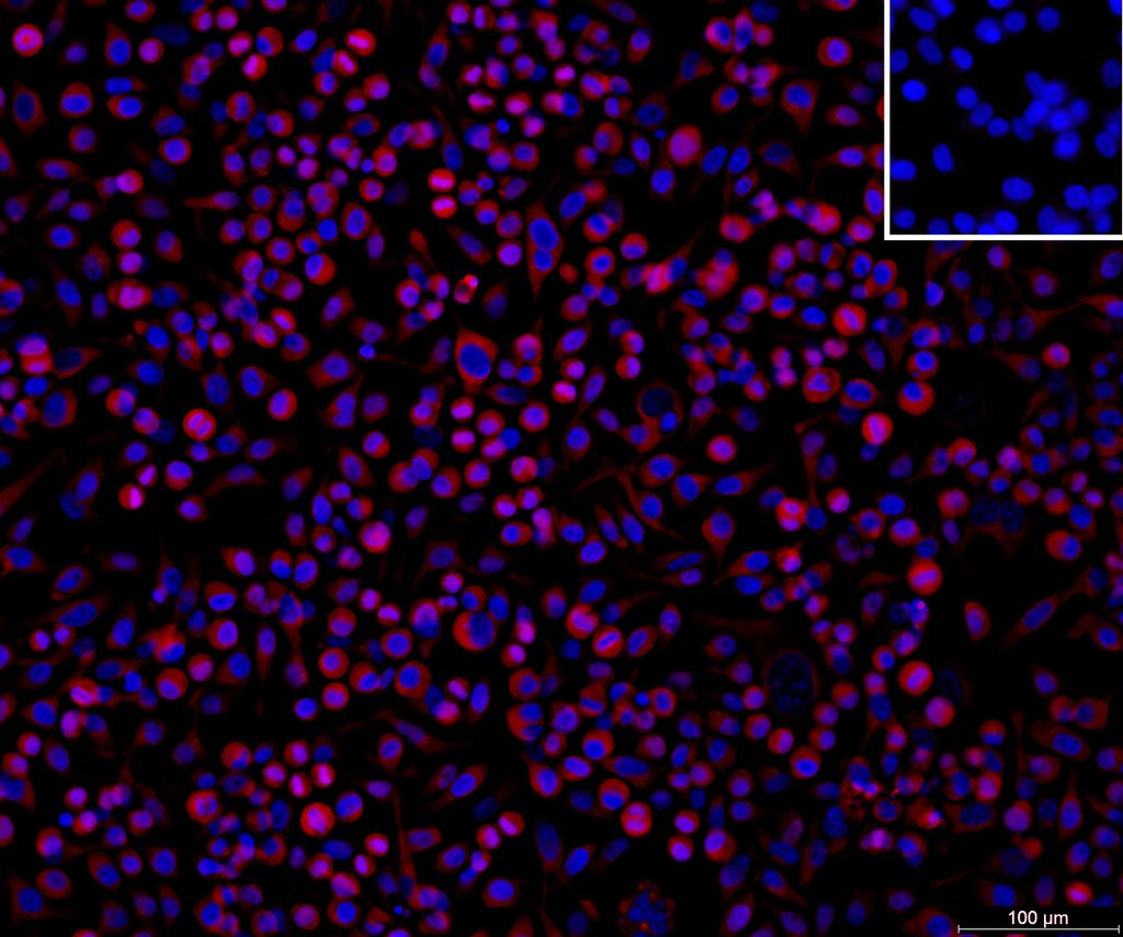 Ankyron ISK4_HUMAN Clone DB40460