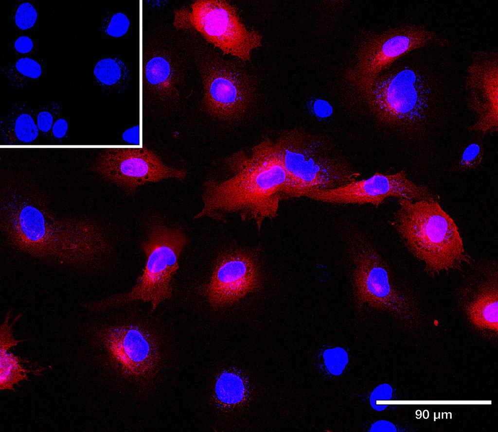 Ankyron ITA5_HUMAN Clone CG30649