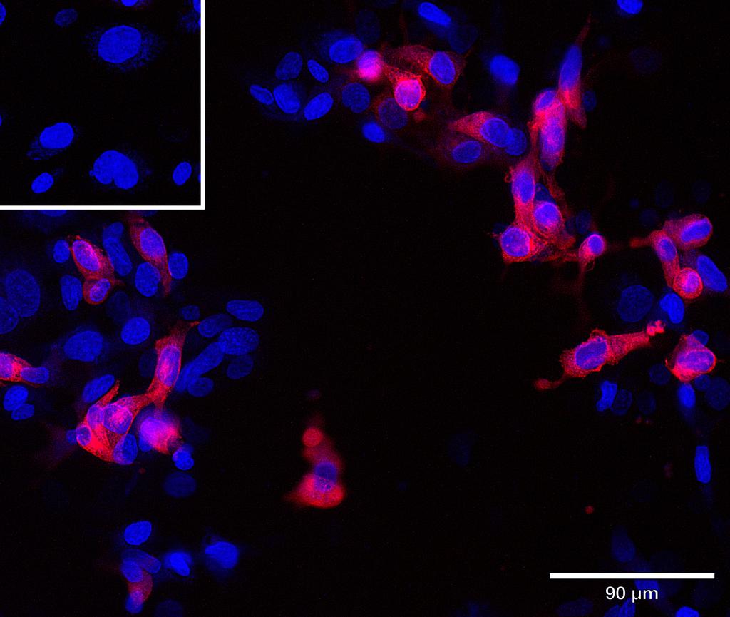 Ankyron ITA6_HUMAN Clone DG40308