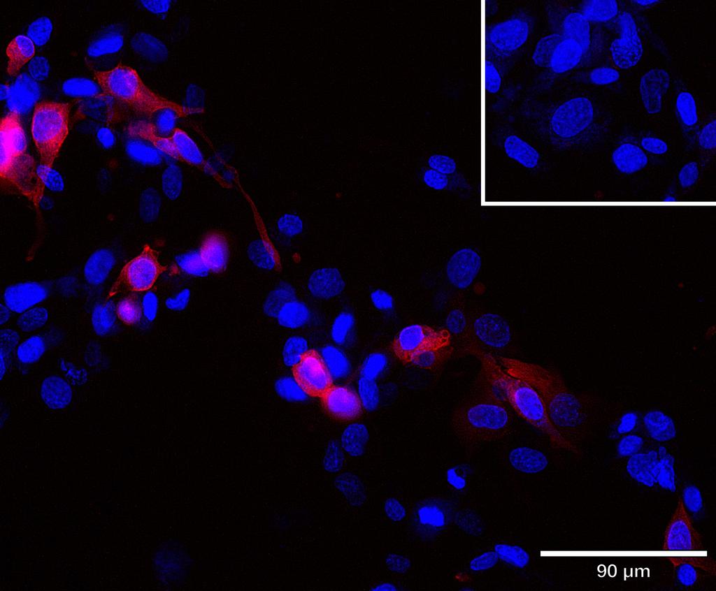 Ankyron ITA6_HUMAN Clone DG40309
