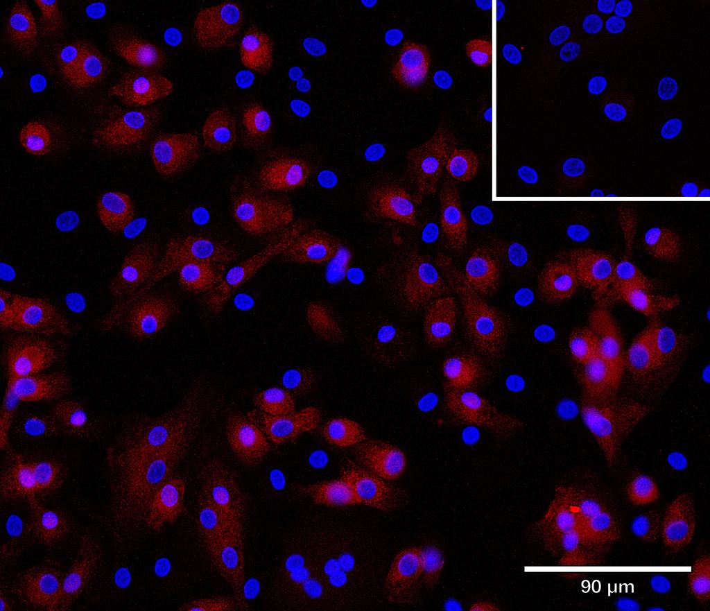 Ankyron ITB1_HUMAN Clone AU41487