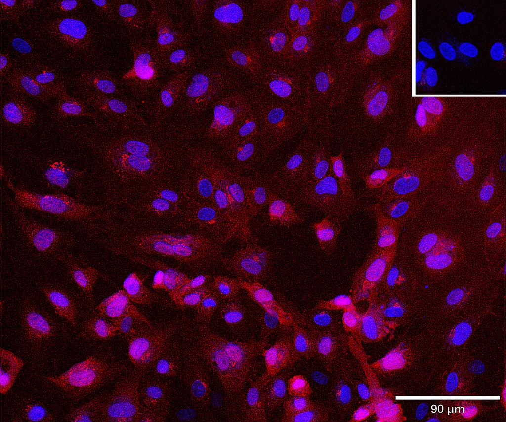 Ankyron ITB4_HUMAN Clone BT40395