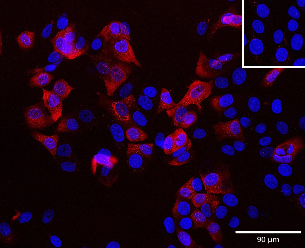Ankyron JAM1_HUMAN Clone BT40260