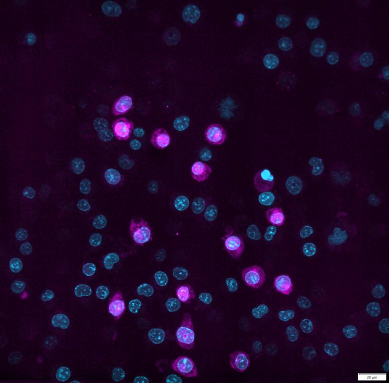 Ankyron JAM1_MOUSE Clone AY40443