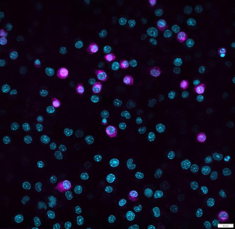 Ankyron JAM1_MOUSE Clone AY40447
