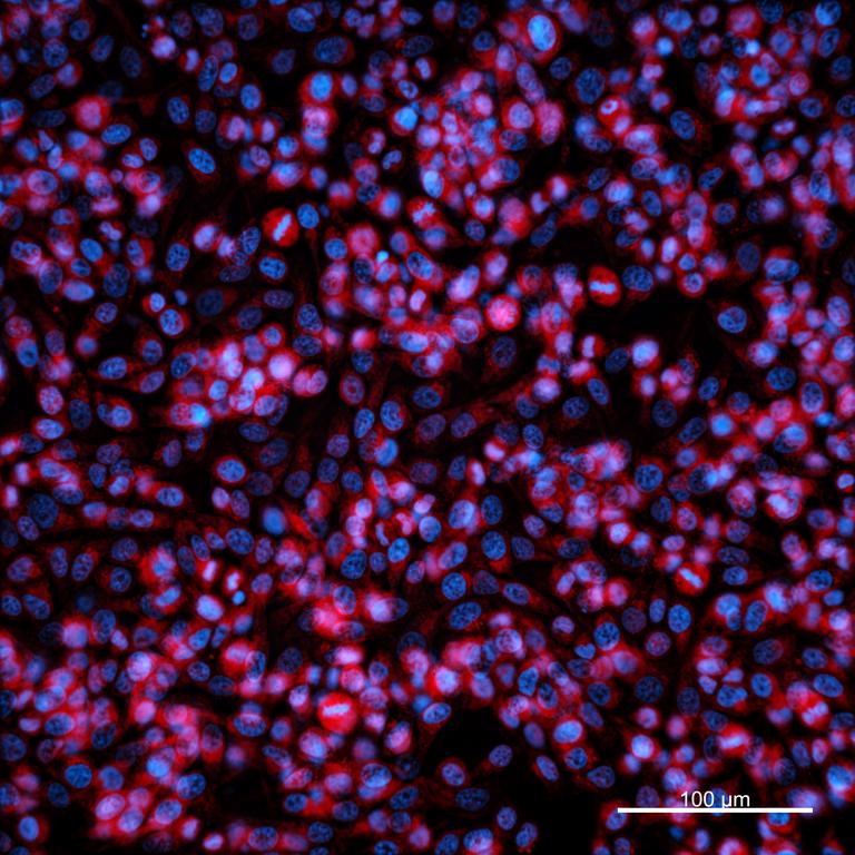 Ankyron KI3L1_HUMAN Clone EM30135