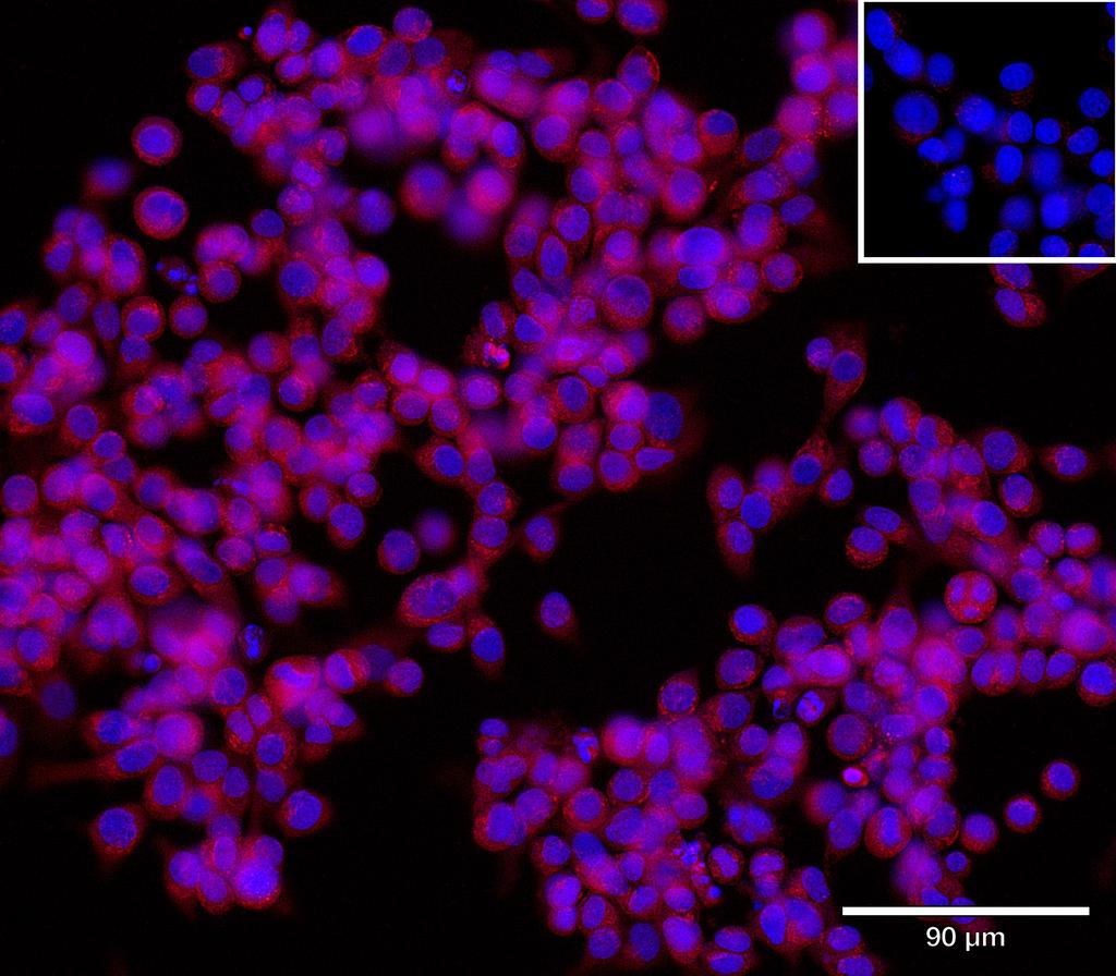 Ankyron KI3L1_HUMAN Clone EM30125
