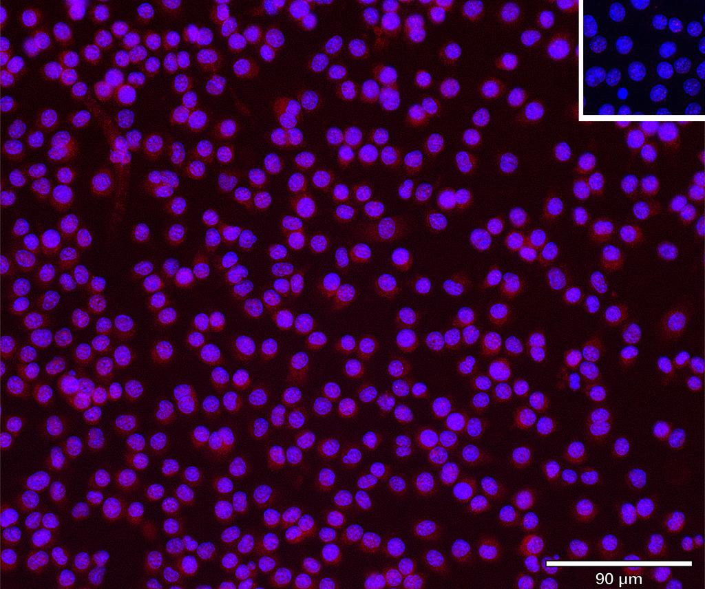 Ankyron KLF4_MOUSE Clone DV40789