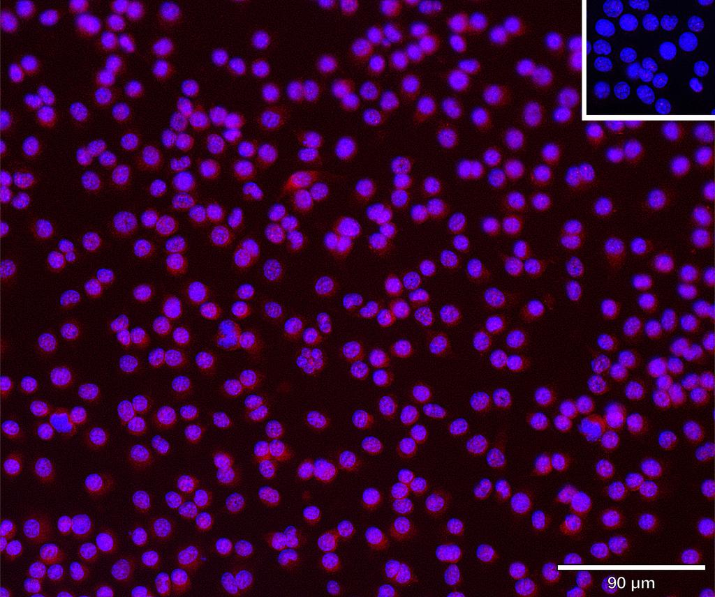 Ankyron KLF4_MOUSE Clone DV40793
