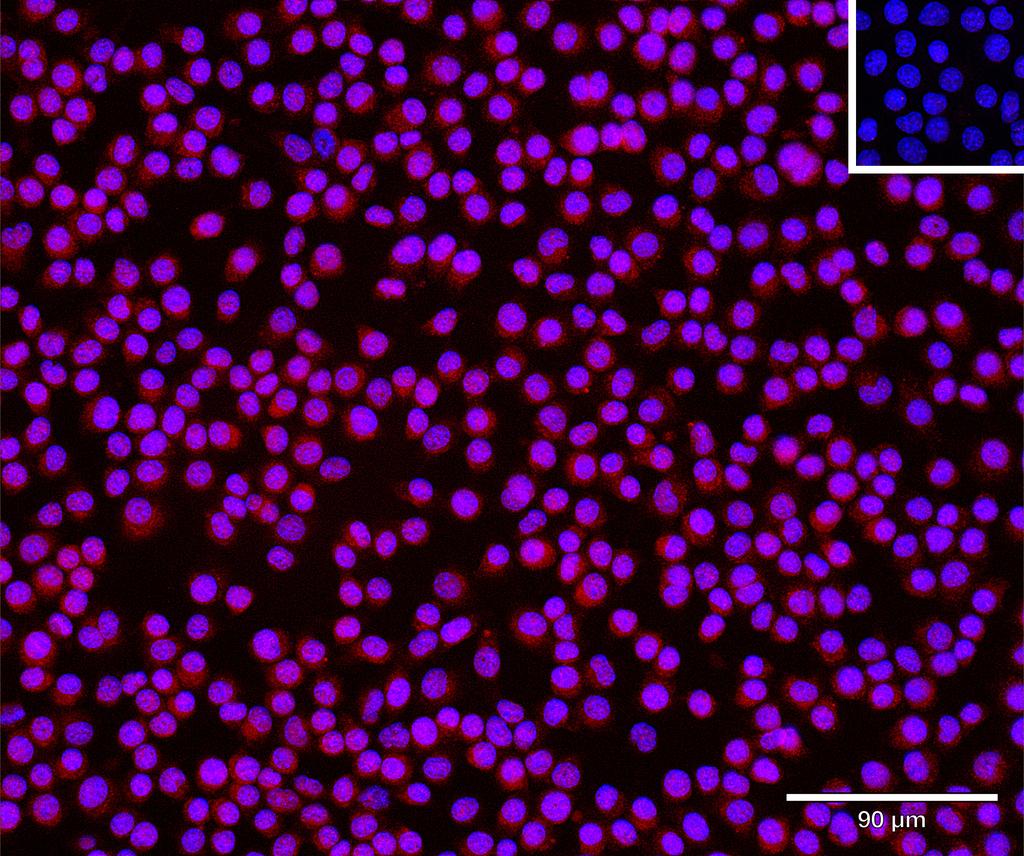 Ankyron KLF4_MOUSE Clone DV40782